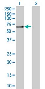 SLC1A3 Antibody in Western Blot (WB)