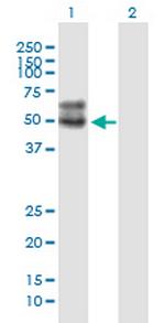 SLC2A4 Antibody in Western Blot (WB)