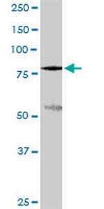 SLC3A1 Antibody in Western Blot (WB)