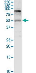 SLC3A2 Antibody in Western Blot (WB)