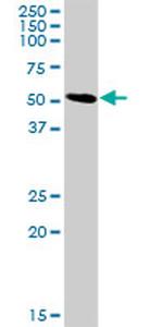 SLC3A2 Antibody in Western Blot (WB)