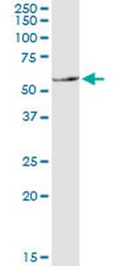 SLC11A1 Antibody in Western Blot (WB)