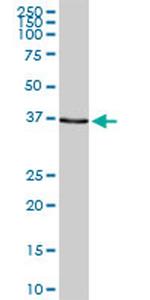 SMARCB1 Antibody in Western Blot (WB)