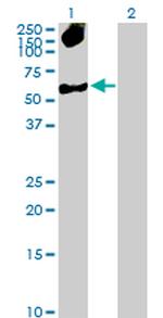 SMARCB1 Antibody in Western Blot (WB)