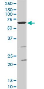 SMARCD3 Antibody in Western Blot (WB)