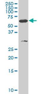 SMARCD3 Antibody in Western Blot (WB)