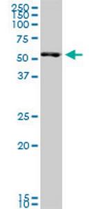 SMARCD3 Antibody in Western Blot (WB)