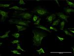 SNCB Antibody in Immunocytochemistry (ICC/IF)