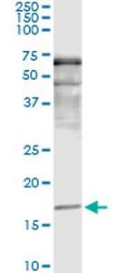 SNCA Antibody in Immunoprecipitation (IP)