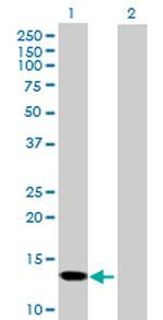 SNCG Antibody in Western Blot (WB)