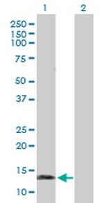 SNCG Antibody in Western Blot (WB)