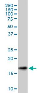 SNCG Antibody in Western Blot (WB)