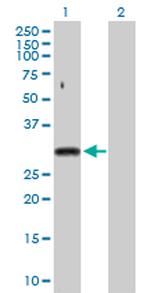 SNRPA Antibody in Western Blot (WB)