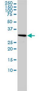 SNRPA Antibody in Western Blot (WB)