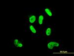 SOX9 Antibody in Immunocytochemistry (ICC/IF)