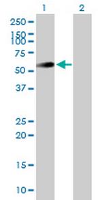 UAP1 Antibody in Western Blot (WB)