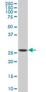 SPI1 Antibody in Western Blot (WB)