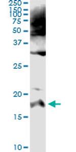 SPINK1 Antibody in Immunoprecipitation (IP)