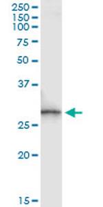 SPR Antibody in Immunoprecipitation (IP)