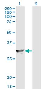 SPR Antibody in Western Blot (WB)