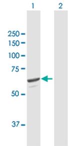 SQLE Antibody in Western Blot (WB)