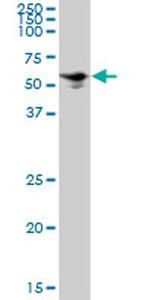 SQLE Antibody in Western Blot (WB)