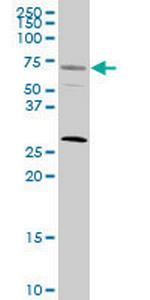 SRF Antibody in Western Blot (WB)