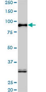 SRPK1 Antibody in Western Blot (WB)