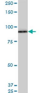 SRPK1 Antibody in Western Blot (WB)