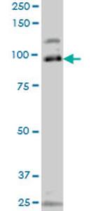 SRPK1 Antibody in Western Blot (WB)