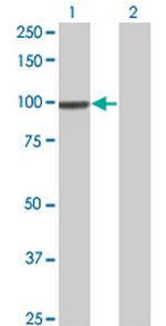 SRPK1 Antibody in Western Blot (WB)