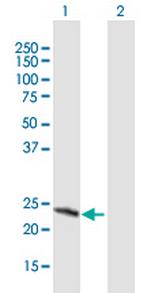 SRY Antibody in Western Blot (WB)