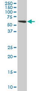 TROVE2 Antibody in Western Blot (WB)