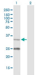 STAR Antibody in Western Blot (WB)