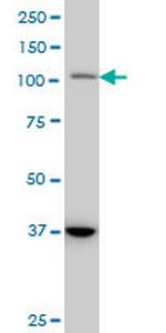 STAT2 Antibody in Western Blot (WB)