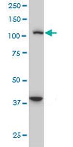 STAT2 Antibody in Western Blot (WB)