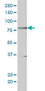 STAT5B Antibody in Western Blot (WB)