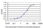 STAT5B Antibody in ELISA (ELISA)