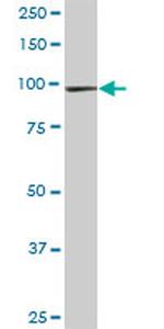 STAT6 Antibody in Western Blot (WB)