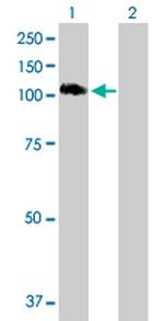 STAT6 Antibody in Western Blot (WB)