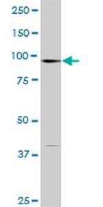 STAT6 Antibody in Western Blot (WB)