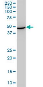 STCH Antibody in Western Blot (WB)