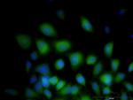 STIM1 Antibody in Immunocytochemistry (ICC/IF)