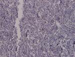 STIM1 Antibody in Immunohistochemistry (Paraffin) (IHC (P))