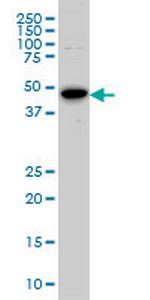 AURKA Antibody in Western Blot (WB)