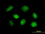 STK11 Antibody in Immunocytochemistry (ICC/IF)