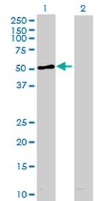 STK11 Antibody in Western Blot (WB)