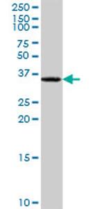 SULT1A1 Antibody in Western Blot (WB)