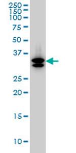 SULT1A3 Antibody in Western Blot (WB)