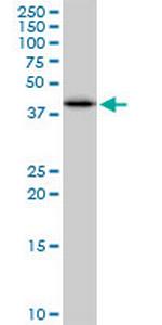 SULT2B1 Antibody in Western Blot (WB)